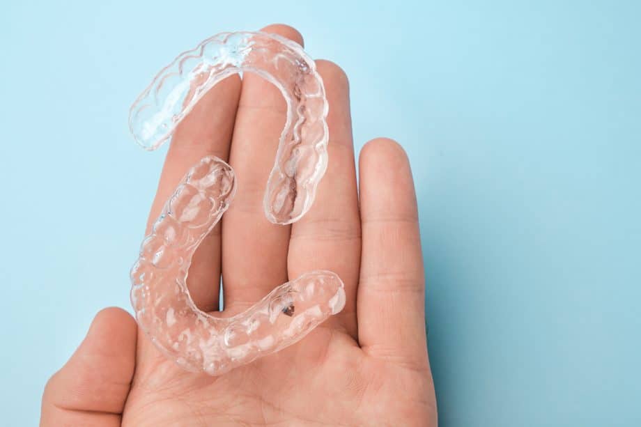 How Do Clear Aligners Work?