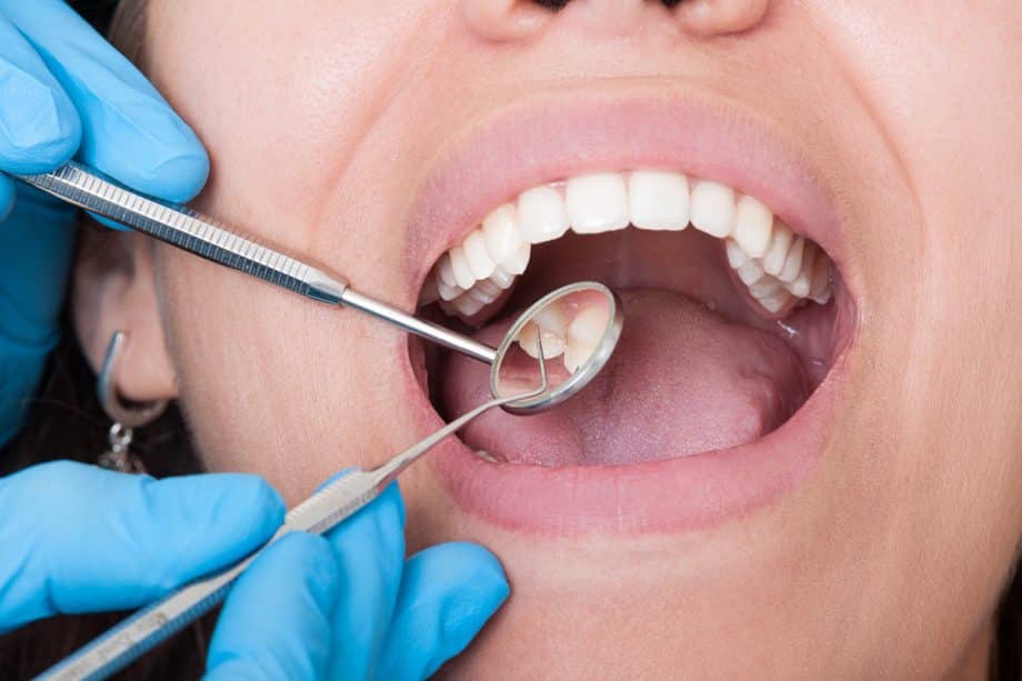 How Often Should You Go to the Dentist?